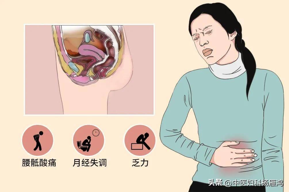 慢性盆腔痛最新疗法研究及进展